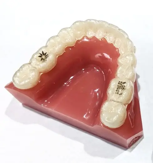 WHAT IS THE Clear Removable Retainers