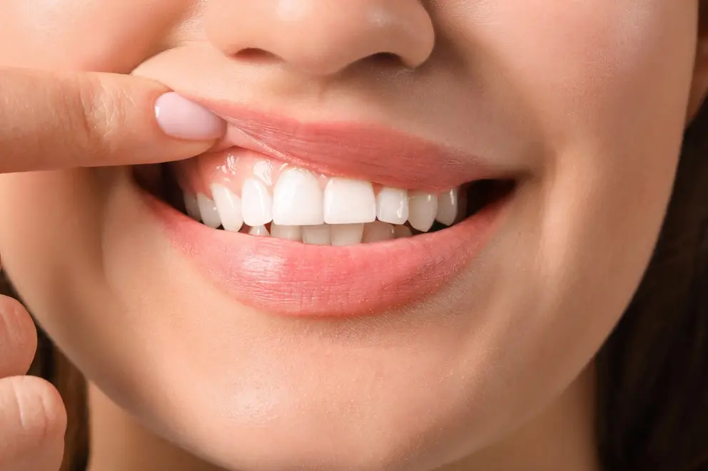 THE IMPORTANCE OF Gum Health