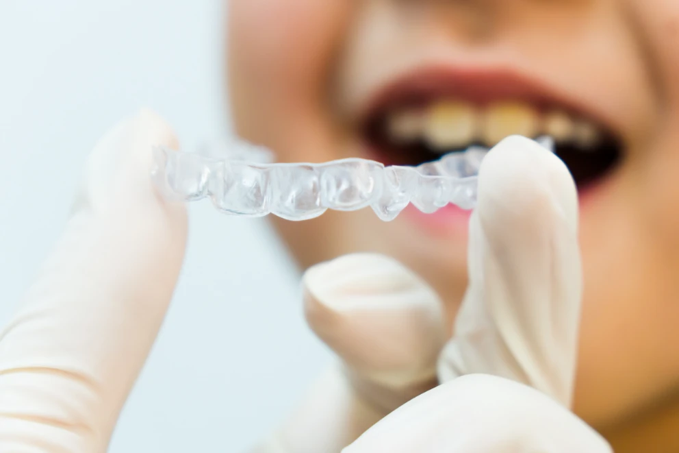 HOW TO Make Your Retainer Fit Again