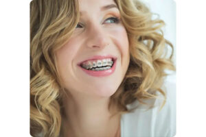 Key Factors to Consider When Choosing an Orthodontist