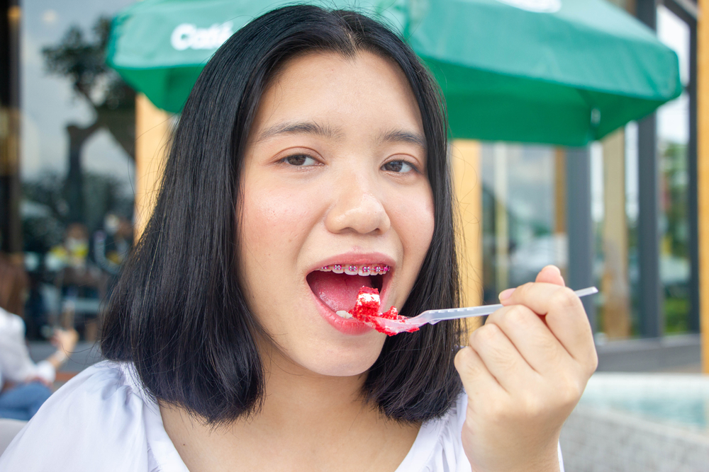 CANDIES You Can Eat With Braces