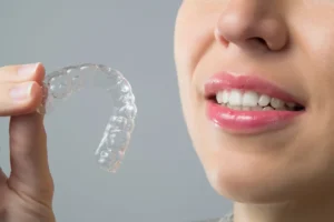 Direct-to-Consumer Aligners