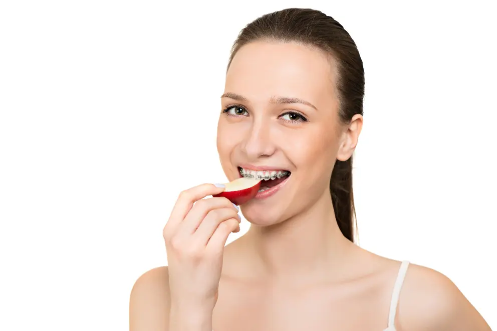 ¿Qué sucede si comes con tus alineadores Invisalign puestos?