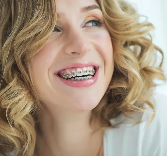 Why Do Teeth Relapse After Braces?