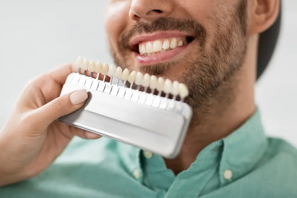 WONDERING IF Braces Or Veneers Are Best For Your Case? Read On to Learn More